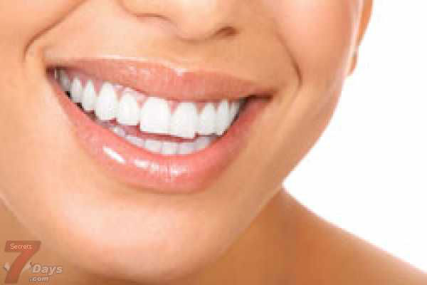وصفة طبيعية لتبييض الاسنان  Fatakat.org_1404929103011